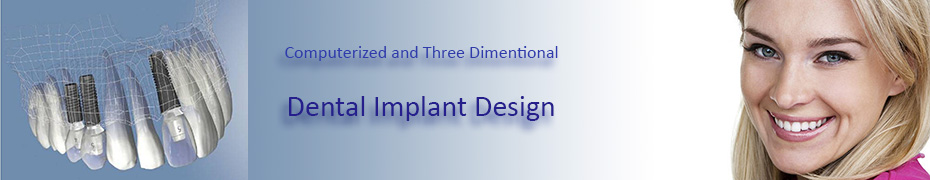 Vancouver Implant